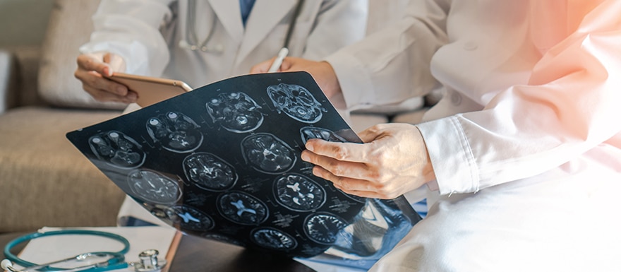 doctors reviewing brain scans